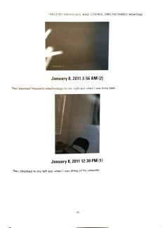 January 8, 2011: attacks on each ear, in bed and at computer
